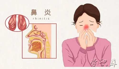 鼻炎的症状都有哪些表现(鼻炎症状的介绍)